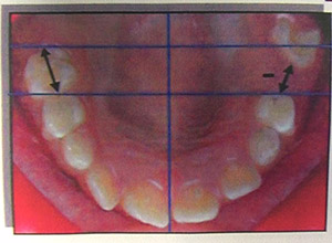 Extraction temporaire 2